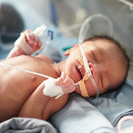 Intensive care treatment for a critically ill new born baby